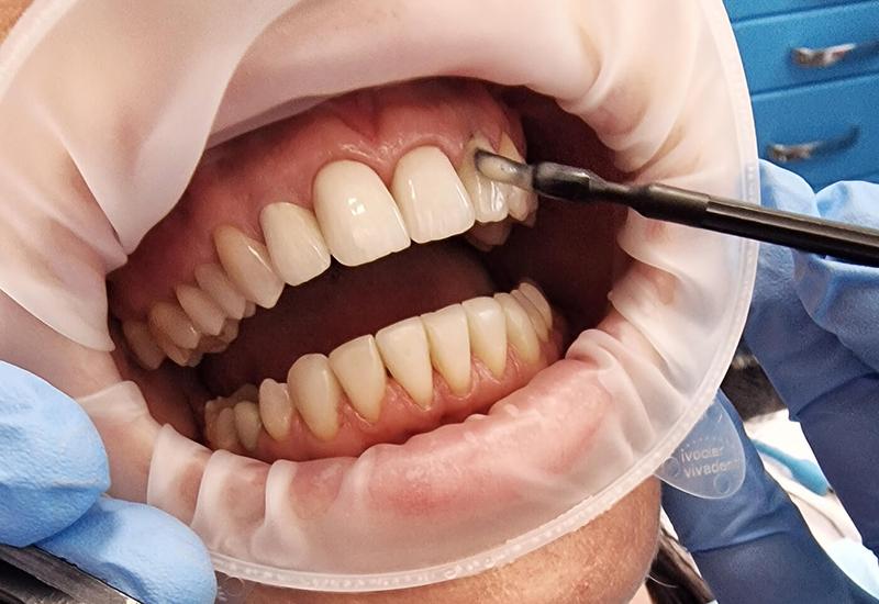 Jak skutecznie przygotować element do lakierowania i uzyskać idealny efekt bez błędów