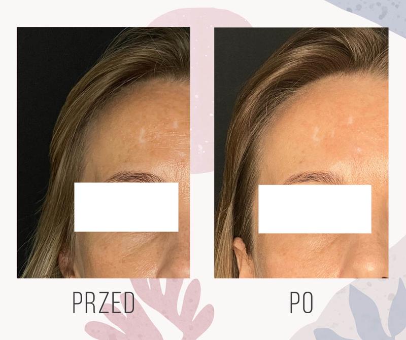 Domowe sposoby na plamy na ścianie